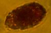 reddish oval with membrane on amber background